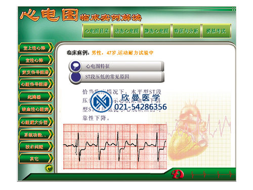 心電圖教學(xué)考核軟件