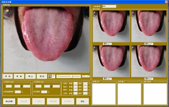 中醫舌診儀舌象采集界面