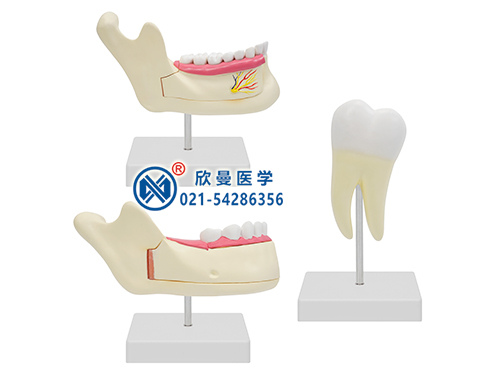 磨牙、乳牙、恒牙模型