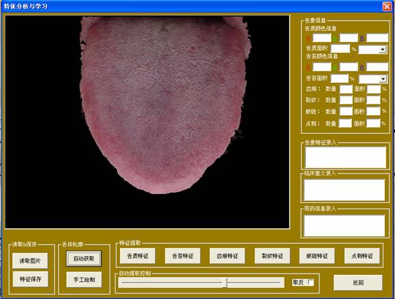 中醫舌像采集分析儀分析與學習界面