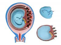 胎兒胎膜與子宮關系模型